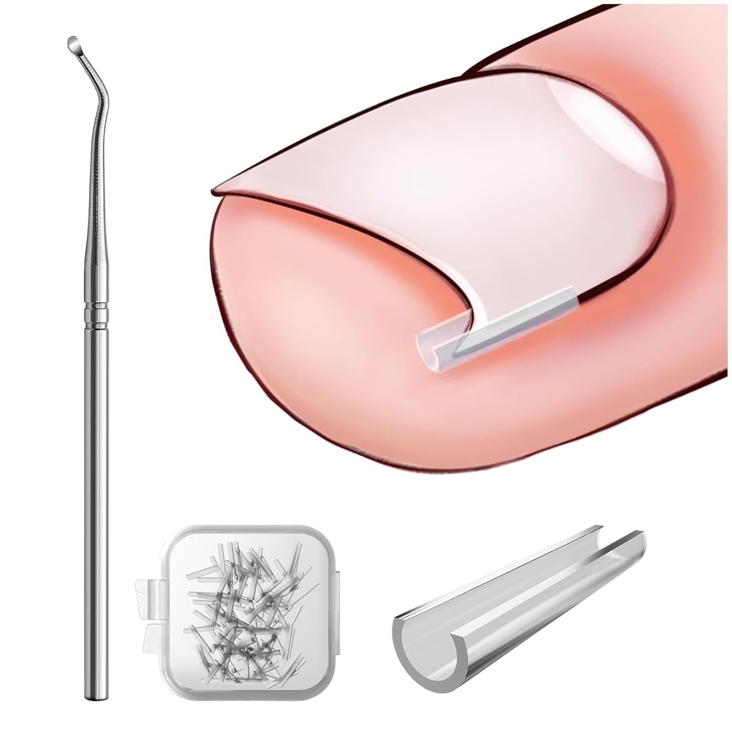 Pain-Free Toenail Straightener Strips with Toenail Lifter